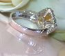 Magnificent Yellow Diamond Ring